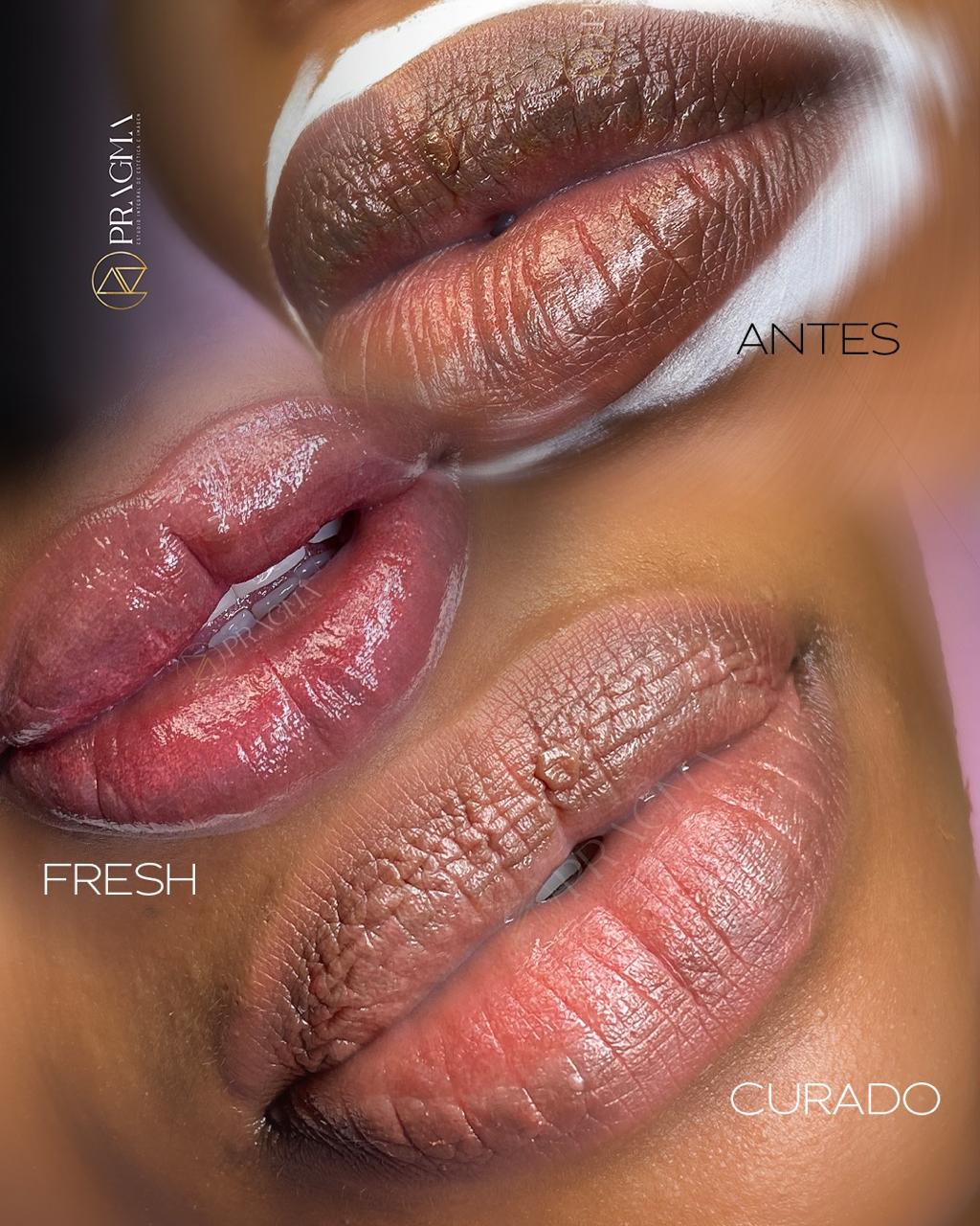 Antes, Fresh y Curado - Labios Pragma
